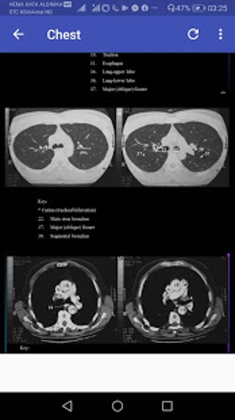Image 0 for CT Scan Anatomy ATLAS