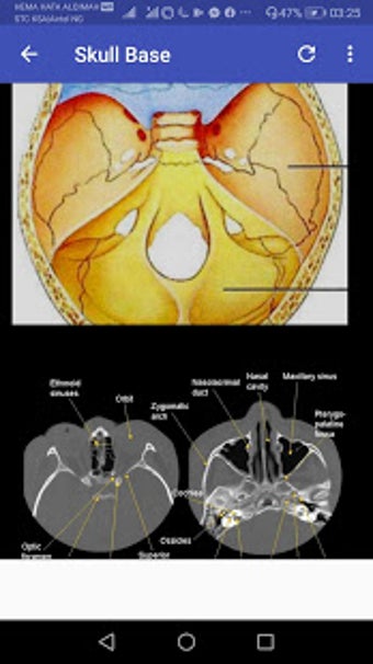 Image 1 for CT Scan Anatomy ATLAS