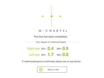 Image 0 for M-Charts