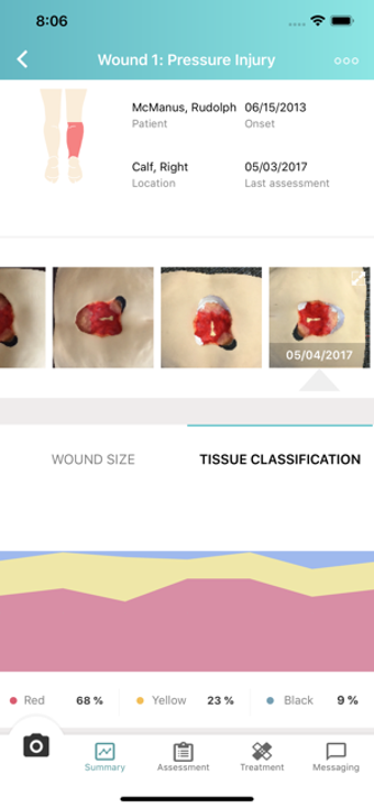 Image 3 for eKare inSight