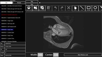 Image 2 for LEADTOOLS DICOM Viewer fo…