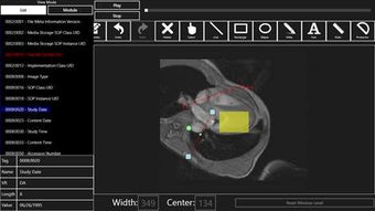 Image 1 for LEADTOOLS DICOM Viewer fo…