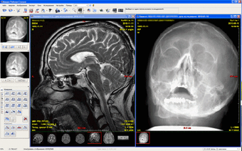 Image 0 for Makhaon PACS Workstation