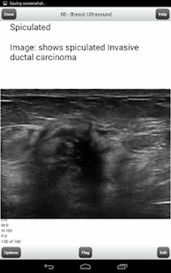 Image 1 for BREAST ULTRASOUND BOARDS …