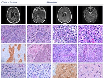 Imagen 2 para Johns Hopkins Atlas of Su…