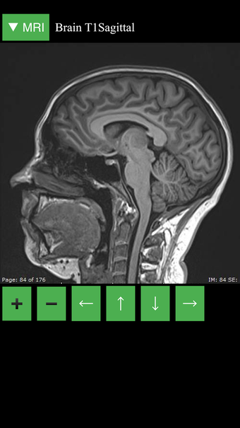 Image 1 for MRI Viewer