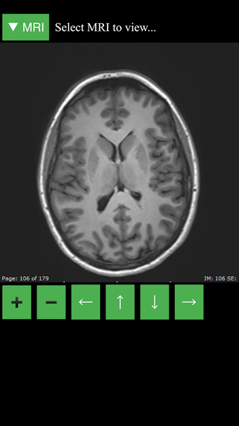 Image 3 for MRI Viewer