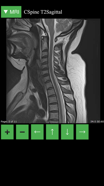 Image 0 for MRI Viewer