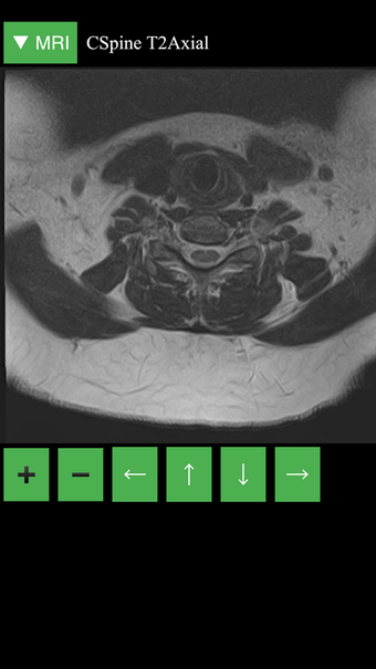 Image 0 for MRI Viewer