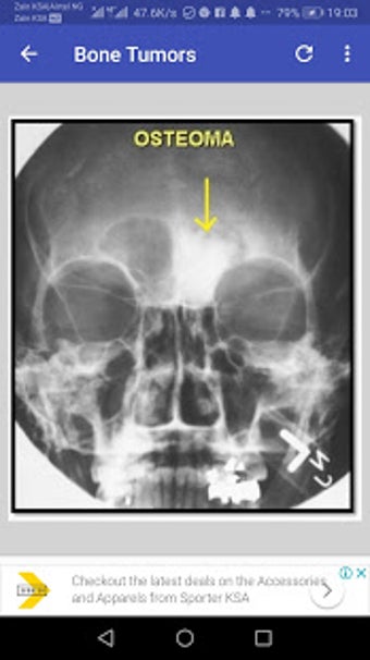 Imagen 0 para Musculoskeletal X- Rays