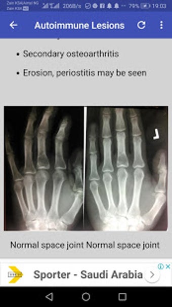 Imagen 2 para Musculoskeletal X- Rays