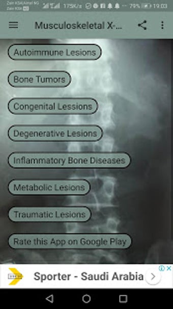 Imagen 3 para Musculoskeletal X- Rays