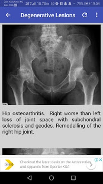 Imagen 1 para Musculoskeletal X- Rays