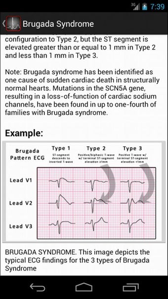Imagen 2 para ECGsource