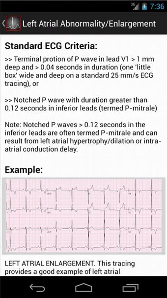 Imagen 1 para ECGsource