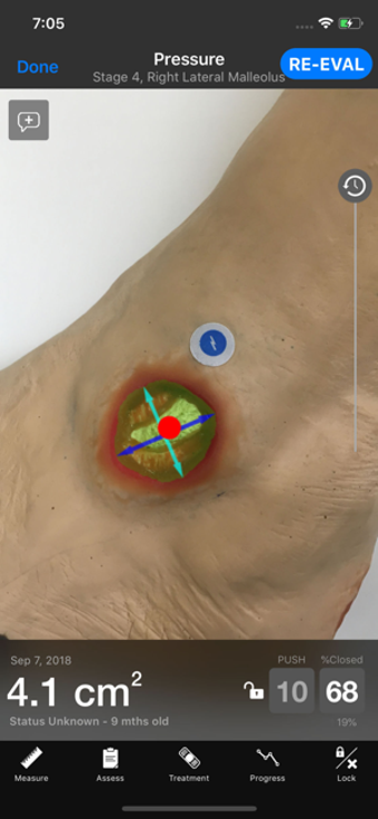 Image 0 for Swift Skin and Wound