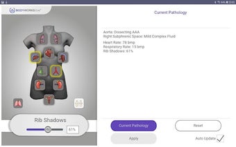 Imagen 0 para Intelligent Ultrasound Si…