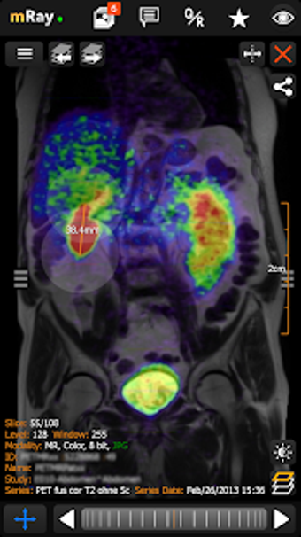 Imagen 3 para mRay - DICOM Viewer