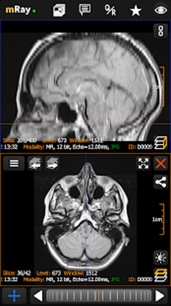 Imagen 1 para mRay - DICOM Viewer