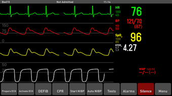 Imagen 1 para TruMonitor - Simulated Pa…