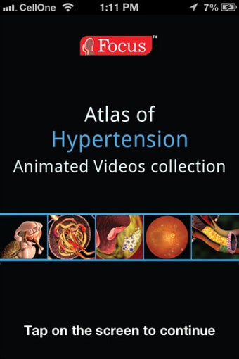 Image 0 for Atlas of Hypertension