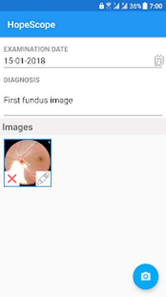 Image 0 for HopeScope