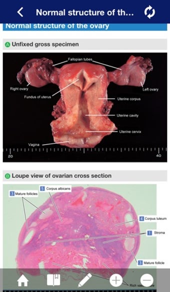 Image 2 for ATLAS OF PATHOLOGY And Co…