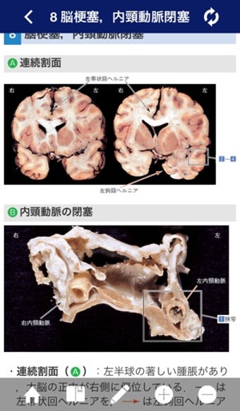 Image 1 for ATLAS OF PATHOLOGY And Co…