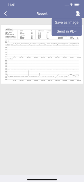 Image 0 for EMAY Bluetooth Pulse Oxim…