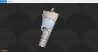 Image 1 for Anomalous Medical