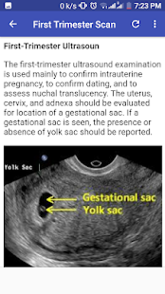 Image 2 for Ultrasound A-Z