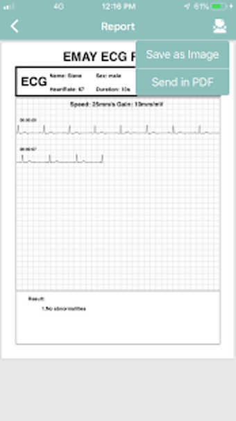 Image 1 for EMAY Portable ECG Monitor