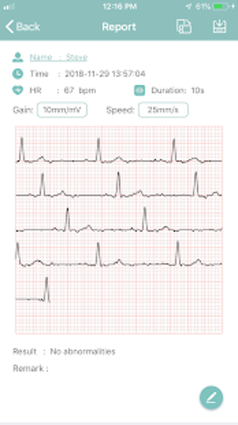 Image 2 for EMAY Portable ECG Monitor