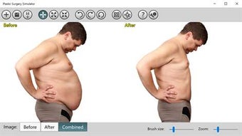 Imagen 2 para Plastic Surgery Simulator…