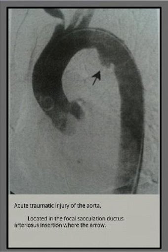 Imagen 2 para Radiology radiographs of …