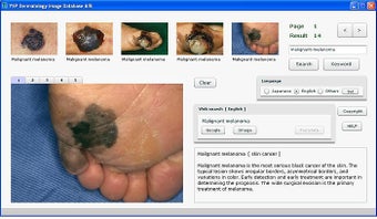 Imagen 0 para YSP Dermatology Image Dat…