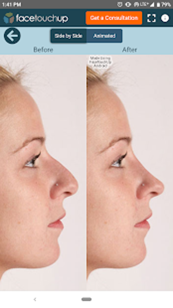 Image 3 for FaceTouchUp Nose Job Simu…