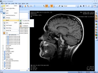 Image 1 for MicroDicom (64-bit)
