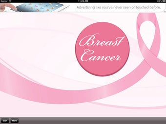 Image 1 for Breast-Cancer