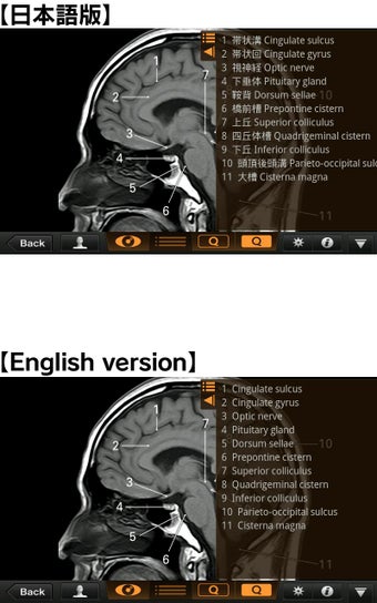 Imagen 2 para Interactive CT & MRI Anat…