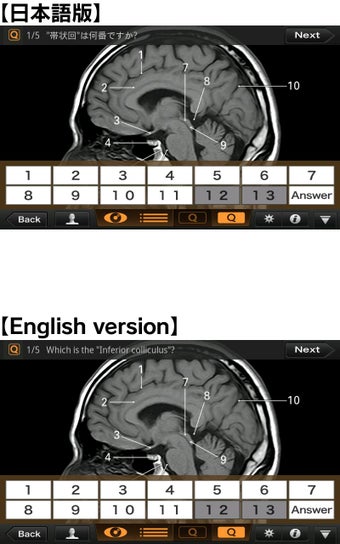 Imagen 1 para Interactive CT & MRI Anat…