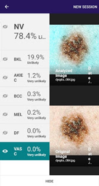 Image 0 for Visus: Skin Cancer Detect…