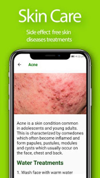 Imagen 3 para Herbal Home Remedies and …
