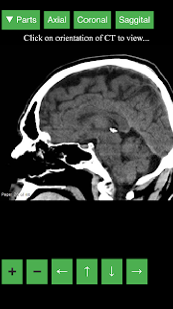 Imagen 0 para Radiology CT Viewer