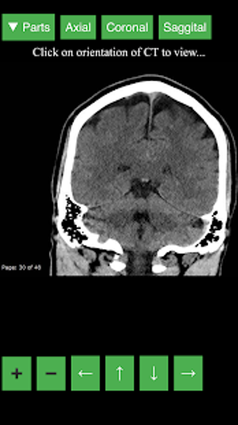 Imagen 2 para Radiology CT Viewer