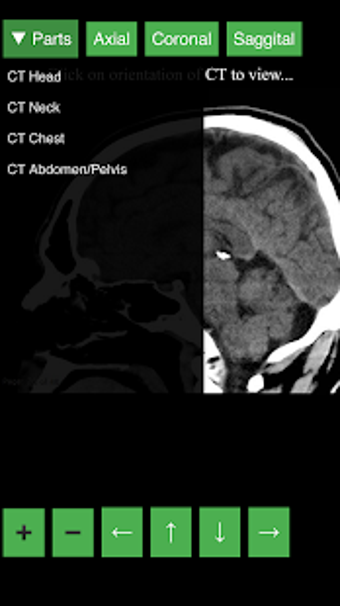 Imagen 3 para Radiology CT Viewer