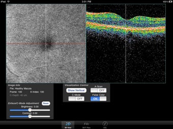 Image 0 for OCT Browser for iPad