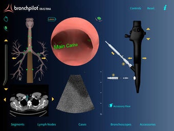 Image 0 for BronchPilot EBUS-TBNA