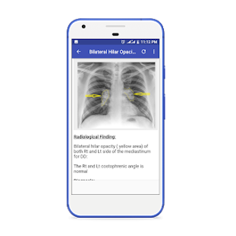 Image 3 for X-Ray Interpretation