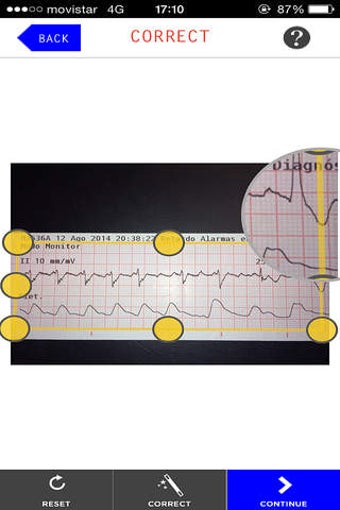 ECG Camera for iOS